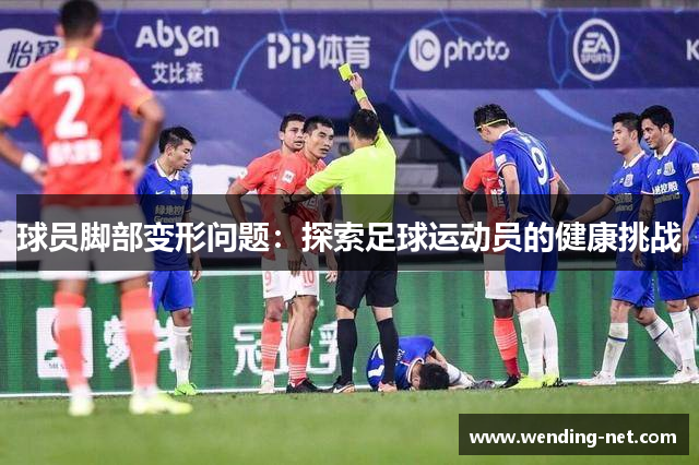 球员脚部变形问题：探索足球运动员的健康挑战